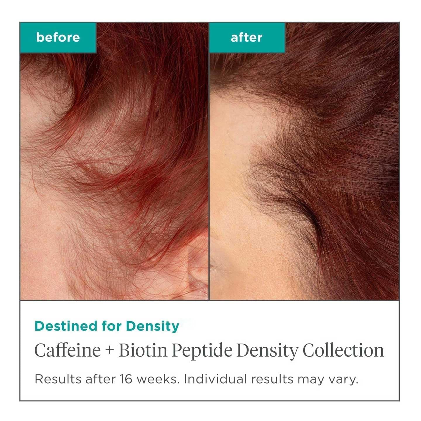 Briogeo Destined for Density Caffeine + Biotin Peptide Density Shampoo & Conditioner Duo | Increases Hair Thickness and Volume for Fine or Thinning Hair | Sulfate-Free | Vegan & Cruelty-Free